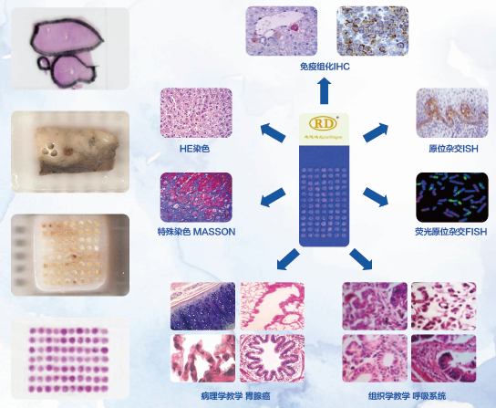 組織芯片定制服務